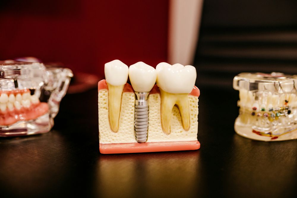 Hvilke alternativer finnes det av tannlege i Vøyenenga?